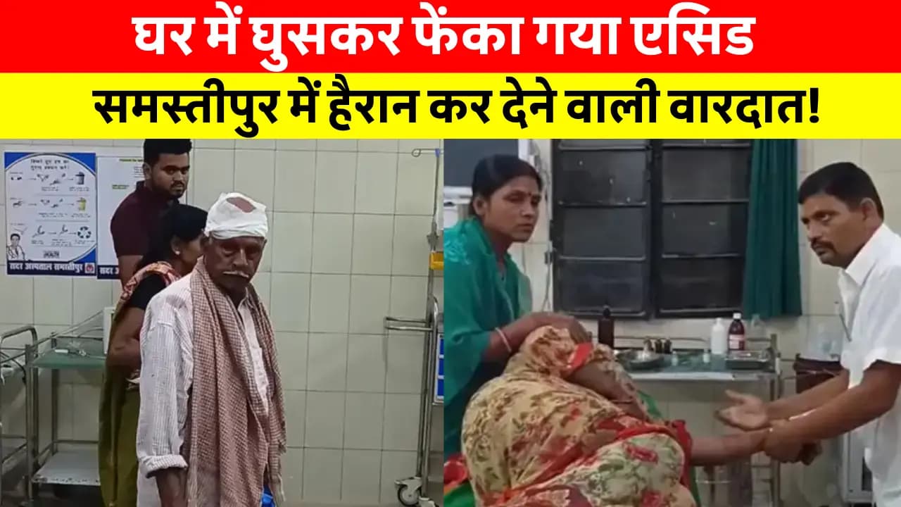 Samastipur News Today: Samastipur में केस नहीं उठाने पर महिला और परिवार पर फेंका गया एसिड! जानिए खौफनाक पूरी कहानी!
